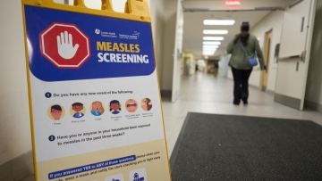 Η ιλαρά «επέστρεψε» στον Καναδά - Χιλιάδες κρούσματα και δύο νεκρά βρέφη, καθώς εμβολιάζεται όλο και λιγότερος κόσμος