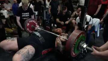 Σοκαριστικός τραυματισμός για το «Βουνό» από το Game of Thrones - Δείτε βίντεο