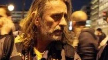 Αναγκαία η χειρουργική επέμβαση στον Μάριο Λώλο