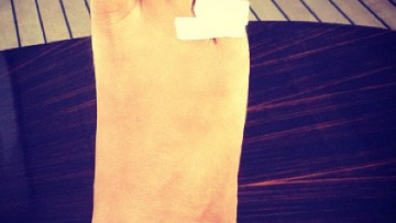 Το σπασμένο δάχτυλο της Rihanna 