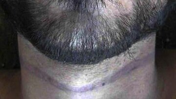 Συρία: Φωτογραφίες-φρίκης αποκαλύπτουν βασανιστήρια και μαζικές εκτελέσεις