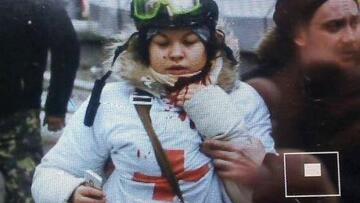 Κίεβο: «Πεθαίνω» - Το συγκλονιστικό tweet νοσοκόμας έπειτα από πυροβολισμό 