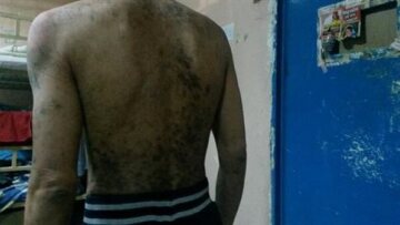 Εικόνες-σοκ μέσα από το νοσοκομείο των φυλακών Κορυδαλλού