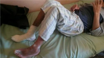 Συμβούλιο της Ευρώπης: Να βελτιωθούν οι συνθήκες στο νοσοκομείο των φυλακών Κορυδαλλού