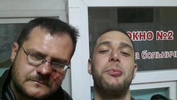 Δείτε φωτογραφία του τραυματισμένου ανταποκριτή της «Καθημερινής» στην Κριμαία