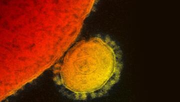 «Καθαροί» από συμπτώματα του MERS και οι 73 που ήρθαν σε επαφή με τον 69χρονο ασθενή