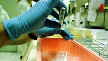 ΗΠΑ: Νέο κρούσμα του κορονοϊού MERS - Θάνατοι σε Ιορδανία και Σαουδική Αραβία