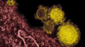 Πρώτο κρούσμα του MERS στη Χάγη