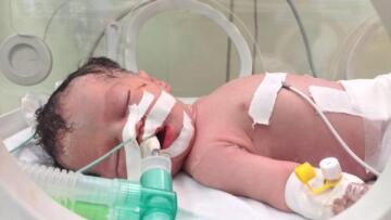 Γάζα: Πέθανε το μωρό-θαύμα που είχε γεννηθεί από νεκρή μητέρα