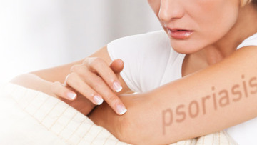 Ψωρίαση: Νέο φάρμακο υπόσχεται στους πάσχοντες καθαρό δέρμα