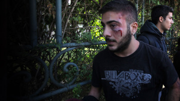 Φοιτητής τραυματίστηκε σε συμπλοκές με τα ΜΑΤ στο Πανεπιστήμιο Αθηνών