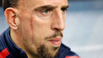 Τρέχει και δε φτάνει ο Ριμπερί με νέο ερωτικό σκάνδαλο!