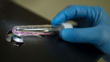 Γαλλία: Πρώτο κρούσμα του ιού Ζίκα μέσω σεξουαλικής επαφής