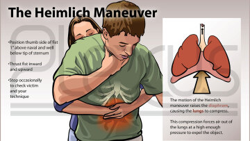 Ο Χένρι Χάιμλιχ έσωσε 87χρονη από πνιγμό χάρη στη... λαβή Χάιμλιχ!