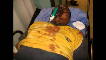 Δίκη Χρυσής Αυγής: 15 μαυροφορεμένοι με χτυπούσαν, μου έσπασαν τα δόντια και το κεφάλι