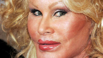 Βίντεο: Η παραμορφωμένη από τις πλαστικές «γυναίκα γάτα» βρίζει και χτυπά τον φίλο της 