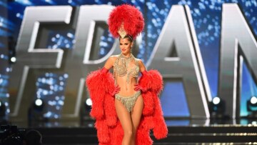 Μια οδοντίατρος από τη Γαλλία η νέα Μις Υφήλιος