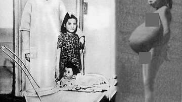 Λίνα Μεδίνα: Η σοκαριστική ιστορία του πεντάχρονου κοριτσιού που έγινε μητέρα 