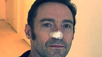 Η νέα «μάχη» του Χιου Τζάκμαν με τον καρκίνο του δέρματος 