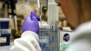 Τα φάρμακα για το AIDS αυξάνουν κατά δέκα χρόνια το προσδόκιμο ζωής  