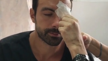 Τραυματισμός για τον Σάκη Τανιμανίδη: Με τσιρότο στο μάτι ο παρουσιαστής!