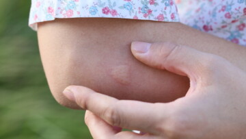 ΚΕΕΛΠΝΟ: Εμφανίστηκε το πρώτο κρούσμα του ιού του Δυτικού Νείλου στη χώρα μας