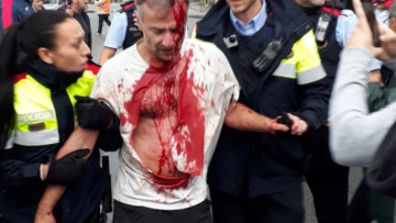 Με αίμα βάφτηκε το δημοψήφισμα των Καταλανών: Απίστευτο ξύλο στους ψηφοφόρους