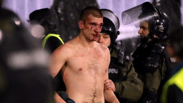 Βελιγράδι: Απίστευτο ξύλο και εικόνες-σοκ με αιματοβαμμένους οπαδούς της Παρτιζάν