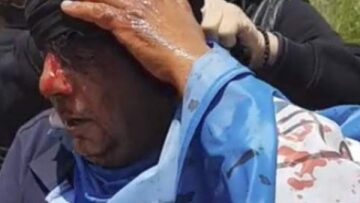 Βίντεο: Viral στο διαδίκτυο η «ματωμένη σημαία» στα επεισόδια στο Πισοδέρι Φλώρινας