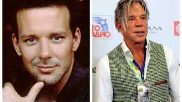 Πέντε διάσημοι που μετάνιωσαν για τις πλαστικές τους... αλλά ήταν αργά