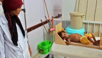 Η πείνα «θερίζει» τα νήπια της Υεμένης: Νεκρά 85.000 παιδιά σε 3 χρόνια πολέμου