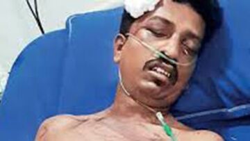 Ινδία: Τον έδεσε σε δένδρο και του έκοψε το πέος επειδή την παρενοχλούσε σεξουαλικά