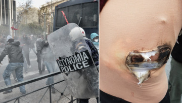 Δείτε βίντεο: Χημικά εναντίον εκπαιδευτικών - Τραυματίστηκε καθηγήτρια