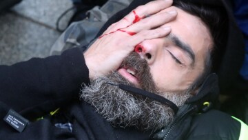 Ηγετική μορφή των Κίτρινων Γιλέκων τραυματίστηκε σοβαρά στο μάτι κατά τη χθεσινή διαδήλωση