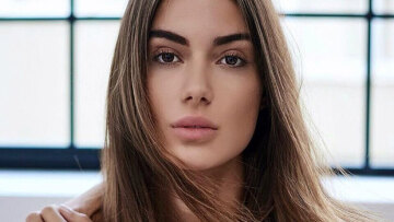 Ιωάννα Μπέλλα: Έβγαλα το υαλουρονικό και νιώθω άλλος άνθρωπος