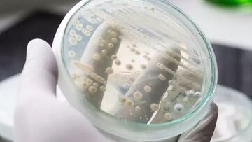 Candida Auris: Ο πολυανθεκτικός μύκητας από τις ΗΠΑ που εξελίχθηκε σε ενδονοσοκομειακή απειλή για όλες τις χώρες