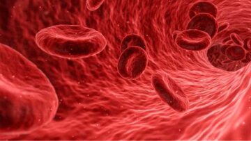 Εγκρίθηκε γονιδιακή θεραπεία για την αντιμετώπιση της Μεσογειακής Αναιμίας