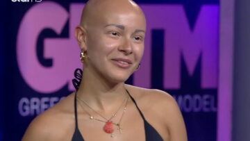 GNTM 2: To νεαρό μοντέλο με την αλωπεκία που συγκίνησε τους κριτές