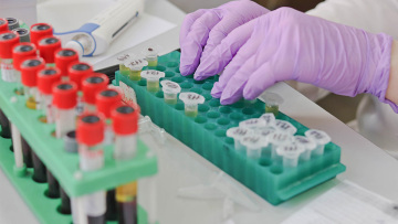 Βρετανοί επιστήμονες μπορεί να βρήκαν θεραπεία για όλους τους καρκίνους 