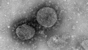 Κοροναϊός: Ερευνητές στο Χονγκ Κονγκ έχουν αναπτύξει ήδη εμβόλιο για την αντιμετώπισή του