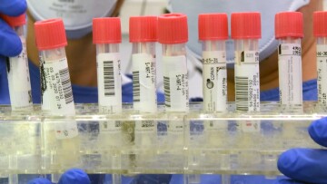 ΠΟΥ για κορωνοϊό: Πιο φονικός από τη γρίπη