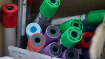 Κορωνοϊός - Θεσσαλονίκη: Προμηθεύεται άμεσα τεστ ταχείας διάγνωσης το νοσοκομείο «Παπαγεωργίου» 