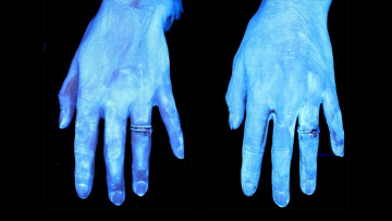 Κορωνοϊός: Υπέρυθρες δείχνουν πώς είναι τα χέρια άπλυτα και πώς πλυμένα - Δείτε φωτογραφίες