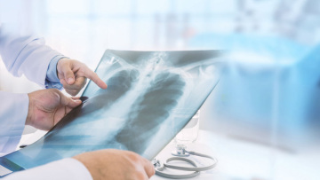 Κορωνοϊός: Τι κάνει στο ανθρώπινο σώμα 