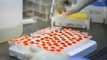 Κορωνοϊός: Το φθινόπωρο ίσως έχουμε τα πρώτα εμβόλια σύμφωνα με το Παστέρ 