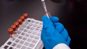 Κορωνοϊός: Η επιπλοκή που οδηγεί σε κατάρρευση τον οργανισμό του ασθενή