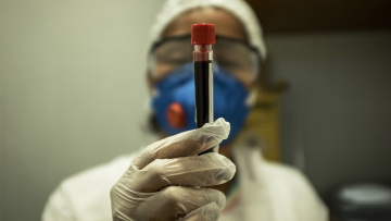 Κι όμως η φερριτίνη μας μπορεί να δείξει αν θα νοσήσουμε σοβαρά από κορωνοϊό!