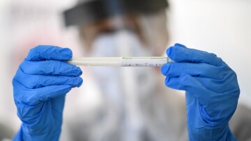 Κορωνοϊός - Βρετανική εταιρεία για εμβόλιο: Σε λίγο καιρό θα δούμε αν θα παρασκευάζουμε ένα εκατομμύριο δόσεις 