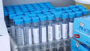 Κορωνοϊός: Νέο τεστ στη Σενεγάλη - Κοστίζει 1 ευρώ και βγάζει αποτέλεσμα σε 10 λεπτά