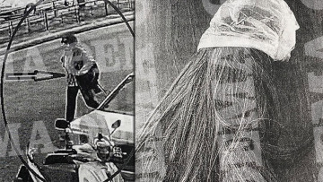 Επίθεση με βιτριόλι: Οι αποκαλυπτικές καταθέσεις της Ιωάννας και του συντρόφου της 35χρονης